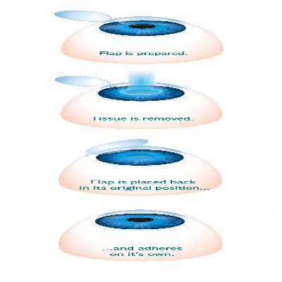 Flap-Based Options